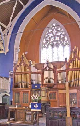 Picture showing organ